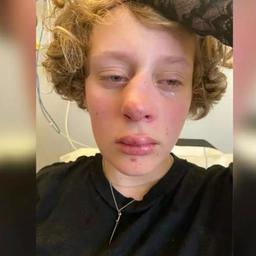 Jongen (14) gearresteerd voor geruchtmakende mishandeling van meisje in Amstelveen
