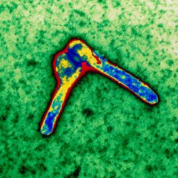 Dode in West-Afrikaans Guinee door zeer zeldzaam marburgvirus