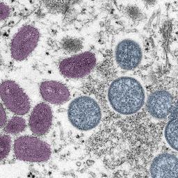 Voor het eerst apenpokkenvirus bij kind in Nederland vastgesteld